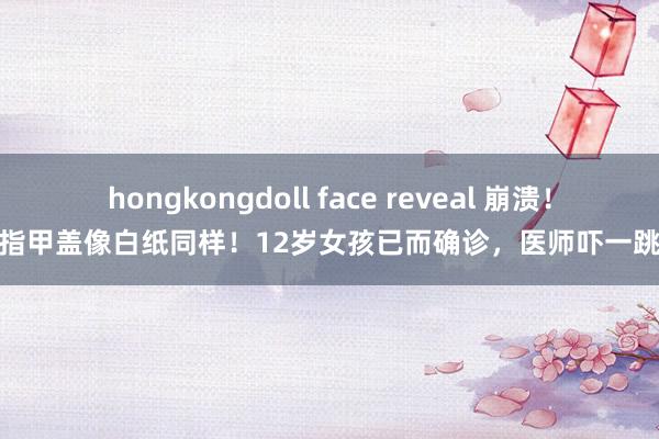 hongkongdoll face reveal 崩溃！指甲盖像白纸同样！12岁女孩已而确诊，医师吓一跳